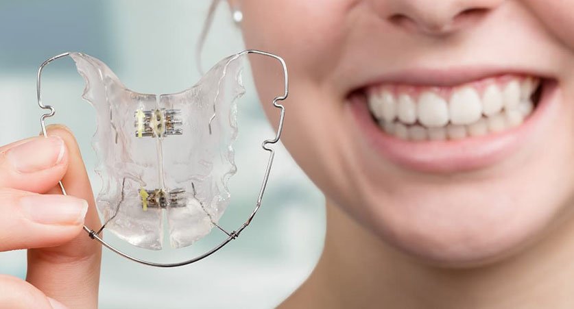 Clear Retainers