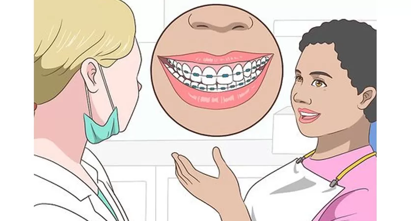 fix underbite