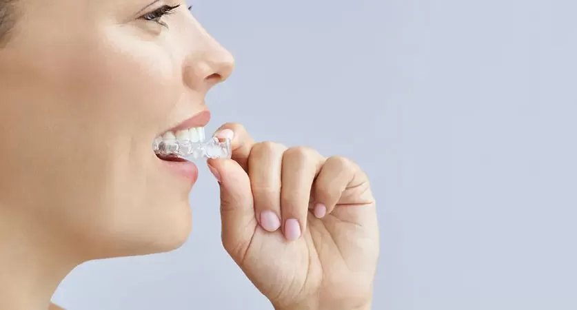 Invisalign Treatment